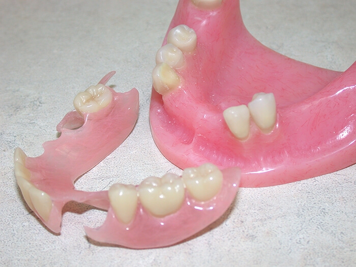 Silva Dental Lab Denture Clinic, Denture Design