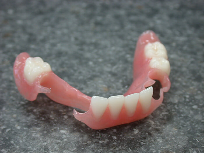 Silva Dental Lab Denture Clinic, Denture Design