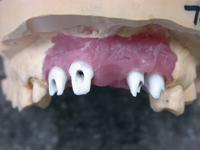 Silva Dental Lab FullService & Support Dental Implant Systems