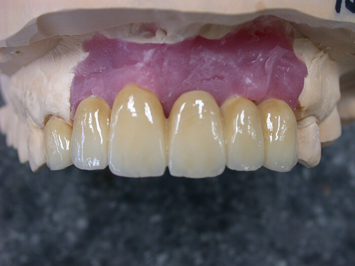 Silva Dental Lab FullService & Support Dental Implant Systems